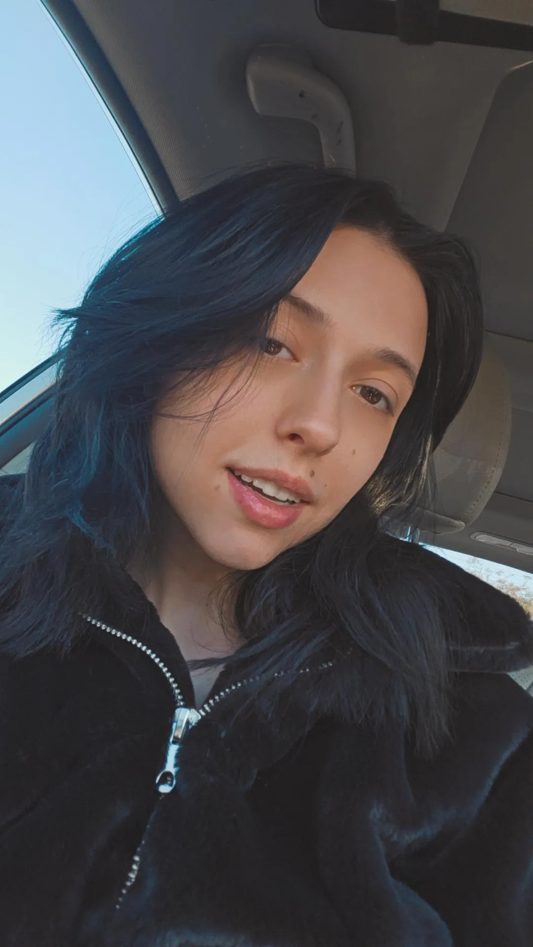 Donyou love my face moles ?