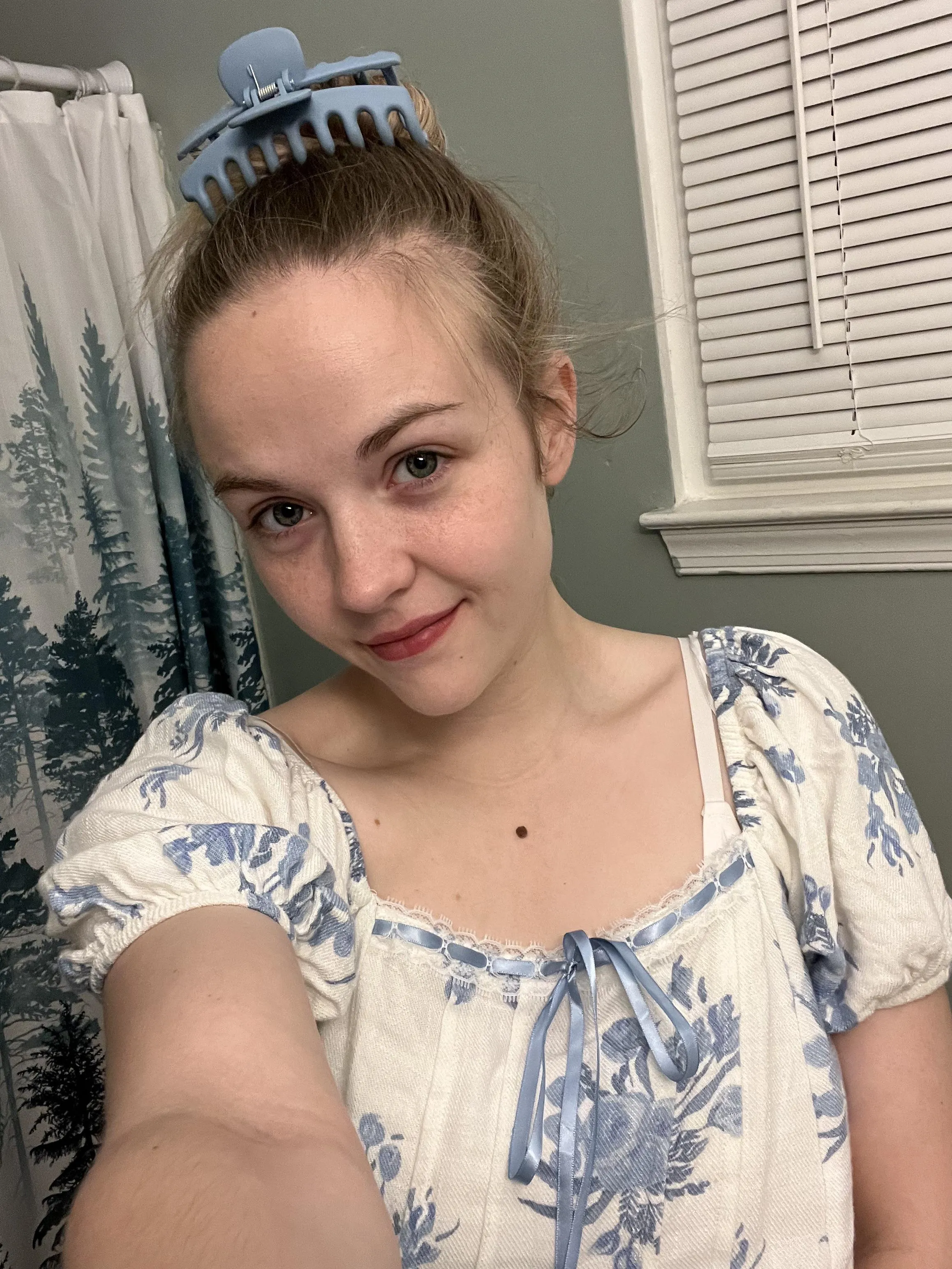 What do you like more, moles or freckles