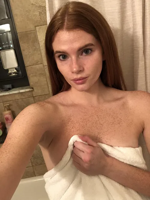 [IRTR] Freckles are out before my shower
