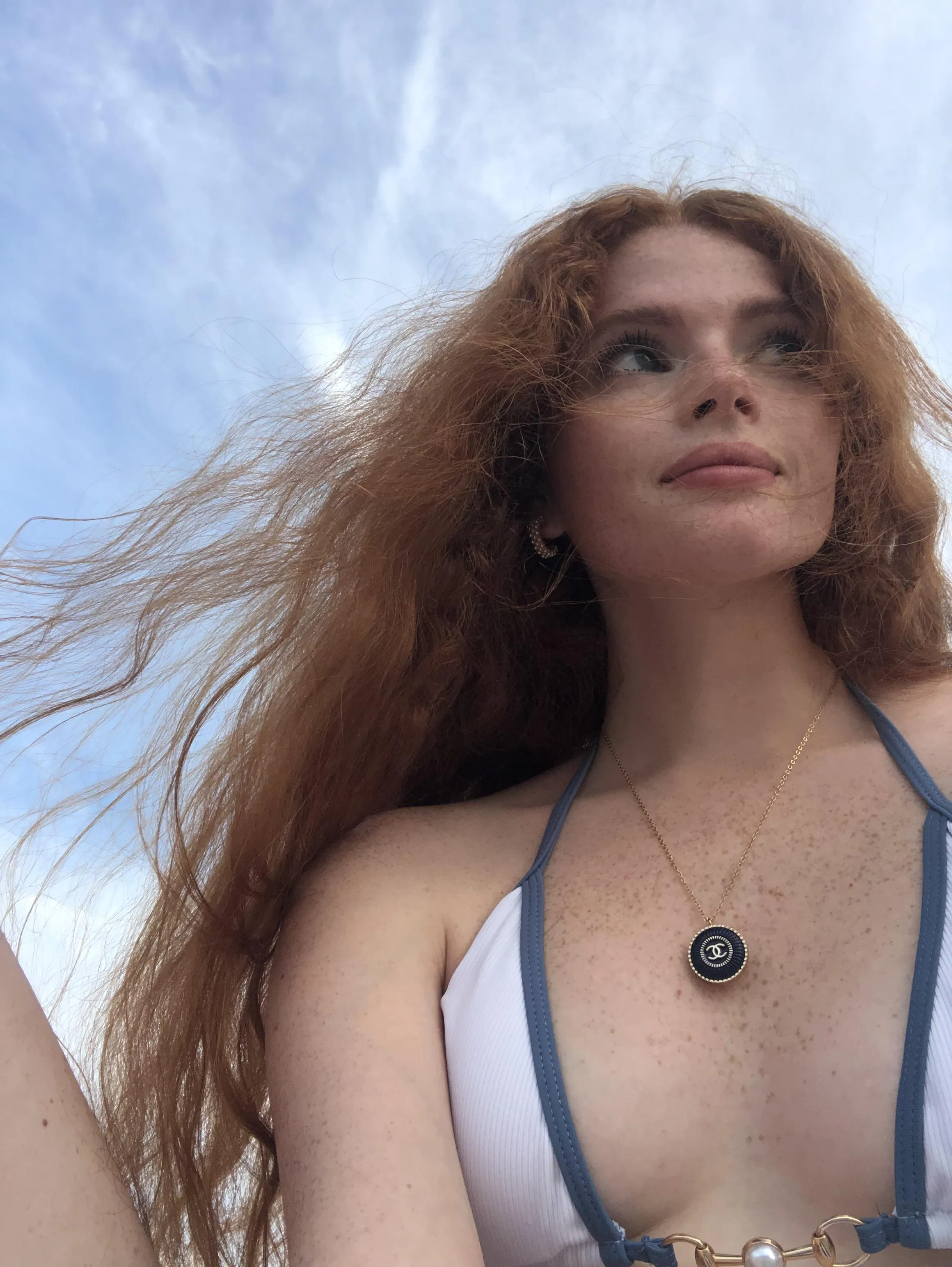 [IRTR] I love having freckles