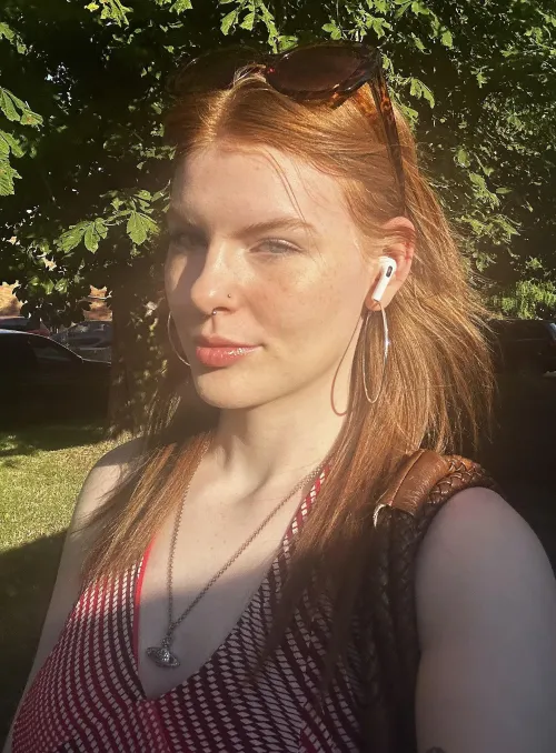 my freckles shine brighter under the sun[IRTR]