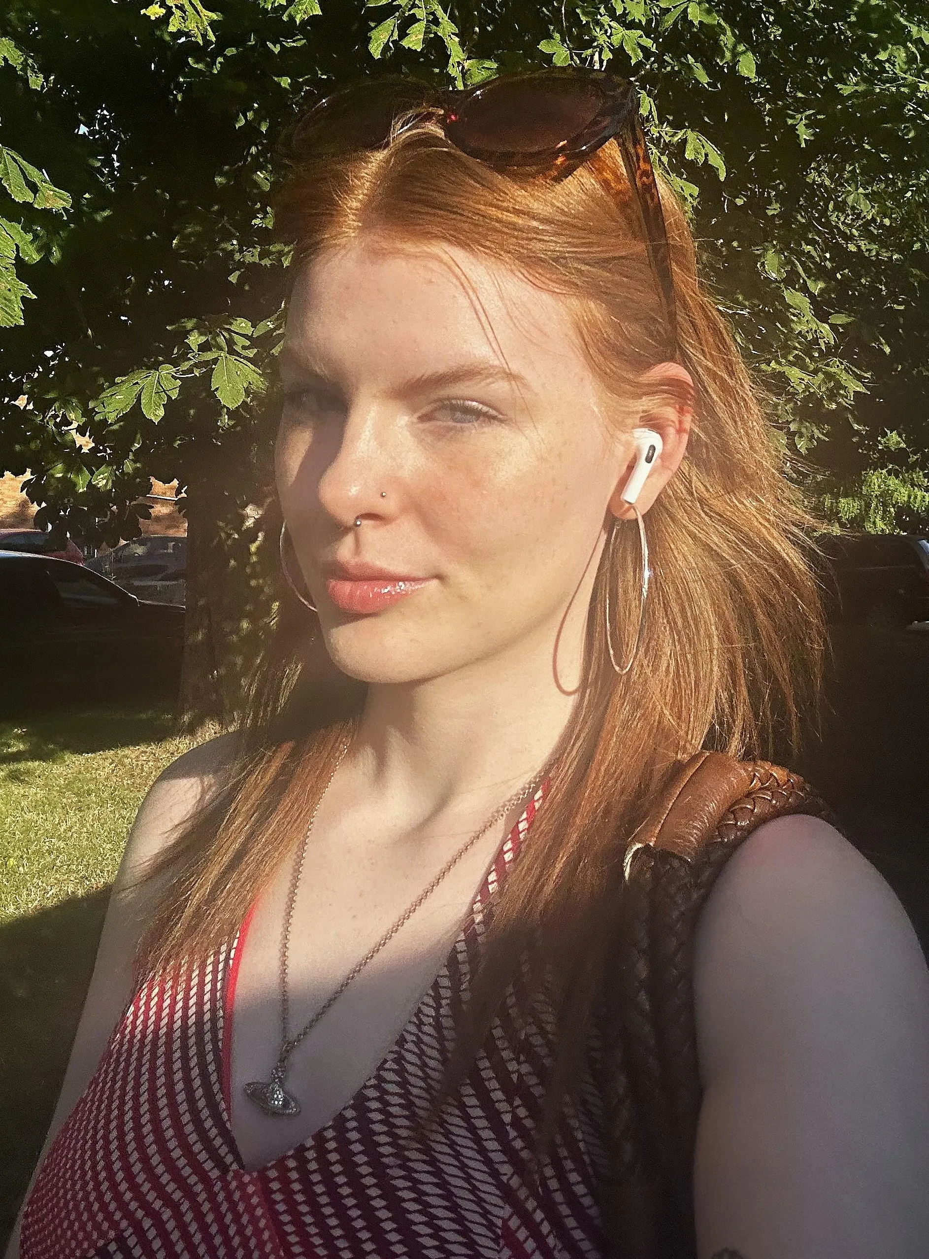 my freckles shine brighter under the sun[IRTR]