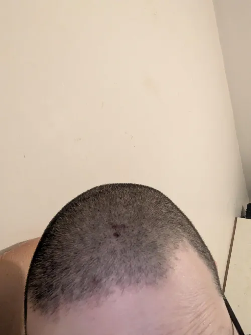 Should I shave it again?