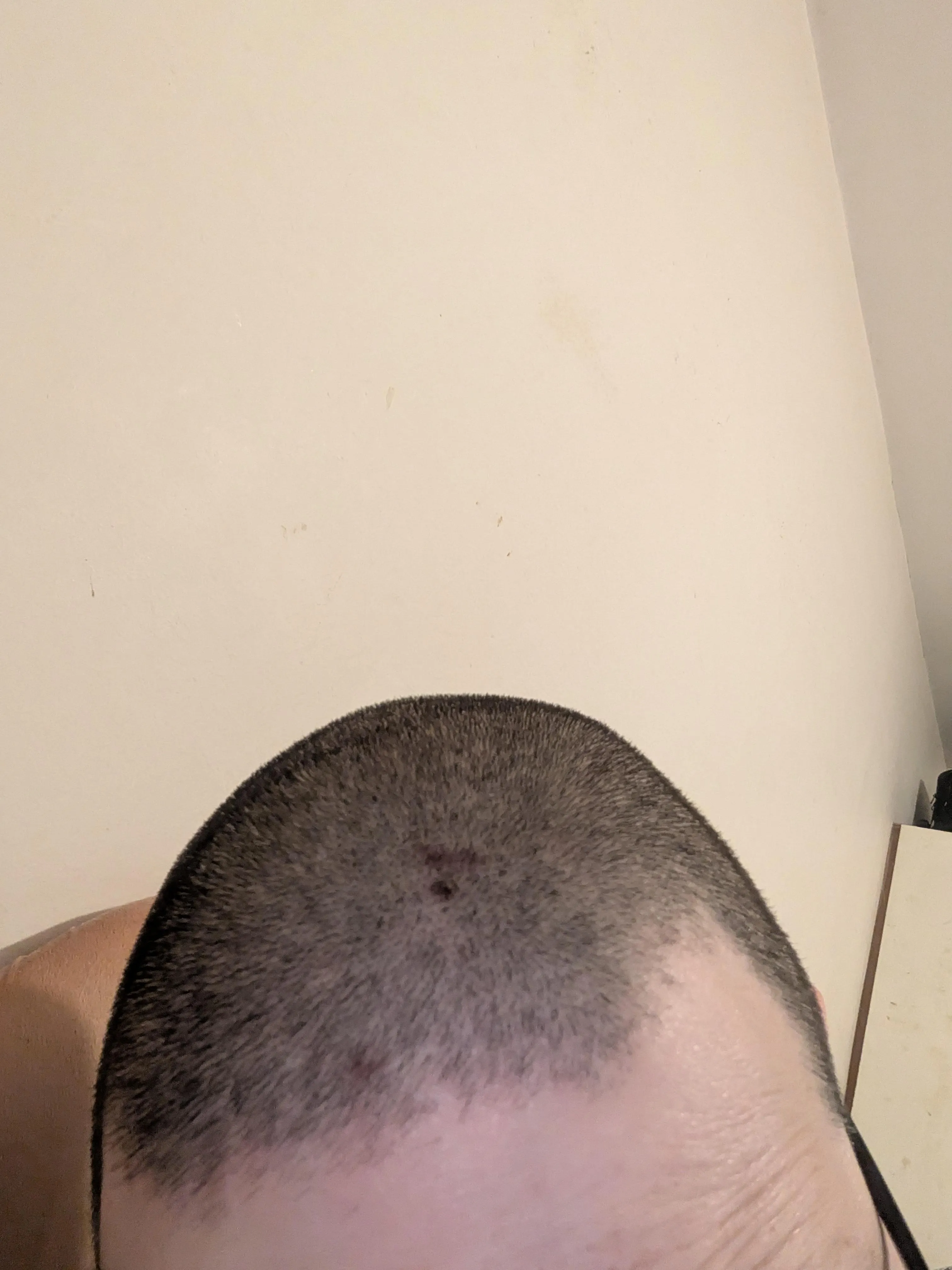 Should I shave it again?