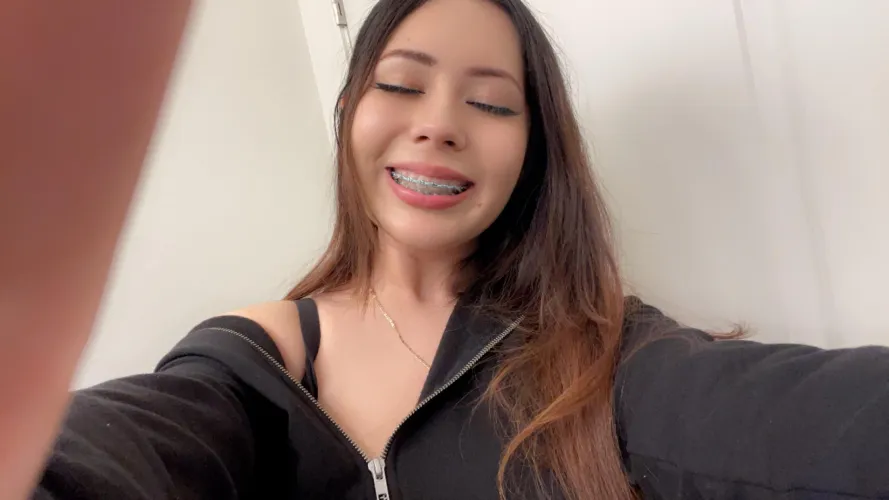 #bluebraces learning to love my smile