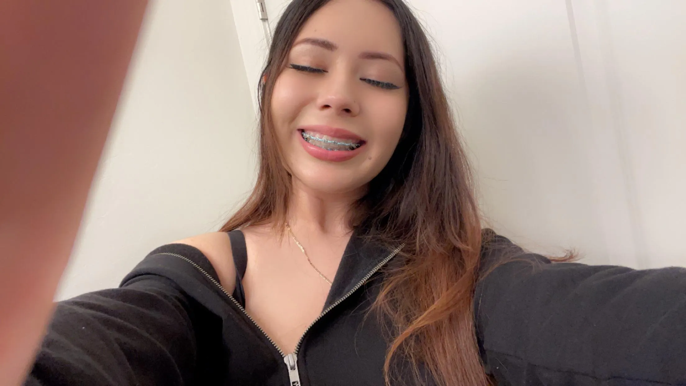 #bluebraces learning to love my smile