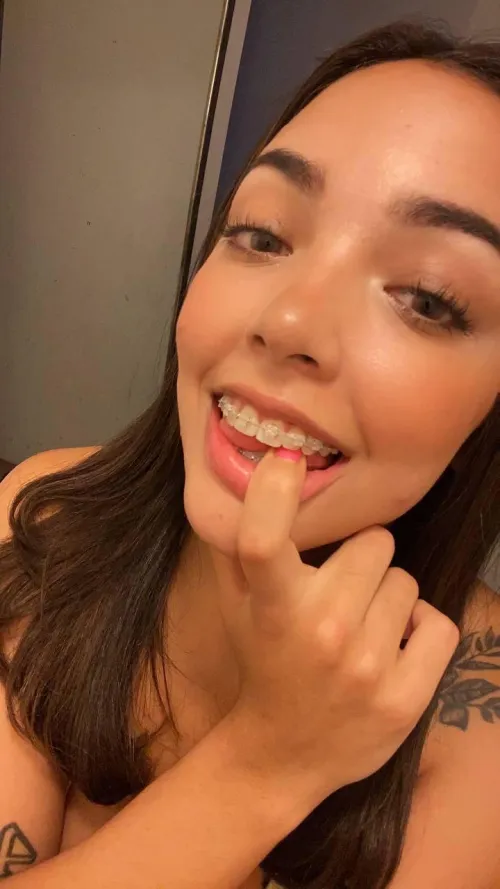 Can you help clean my braces with your cream?