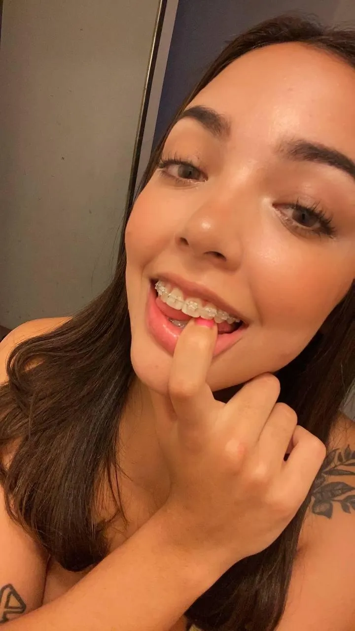 Can you help clean my braces with your cream?