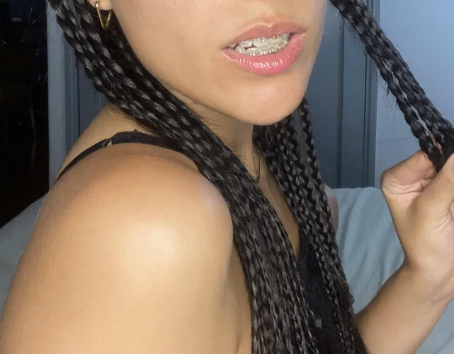 Can you resist my braces? 🥵👄