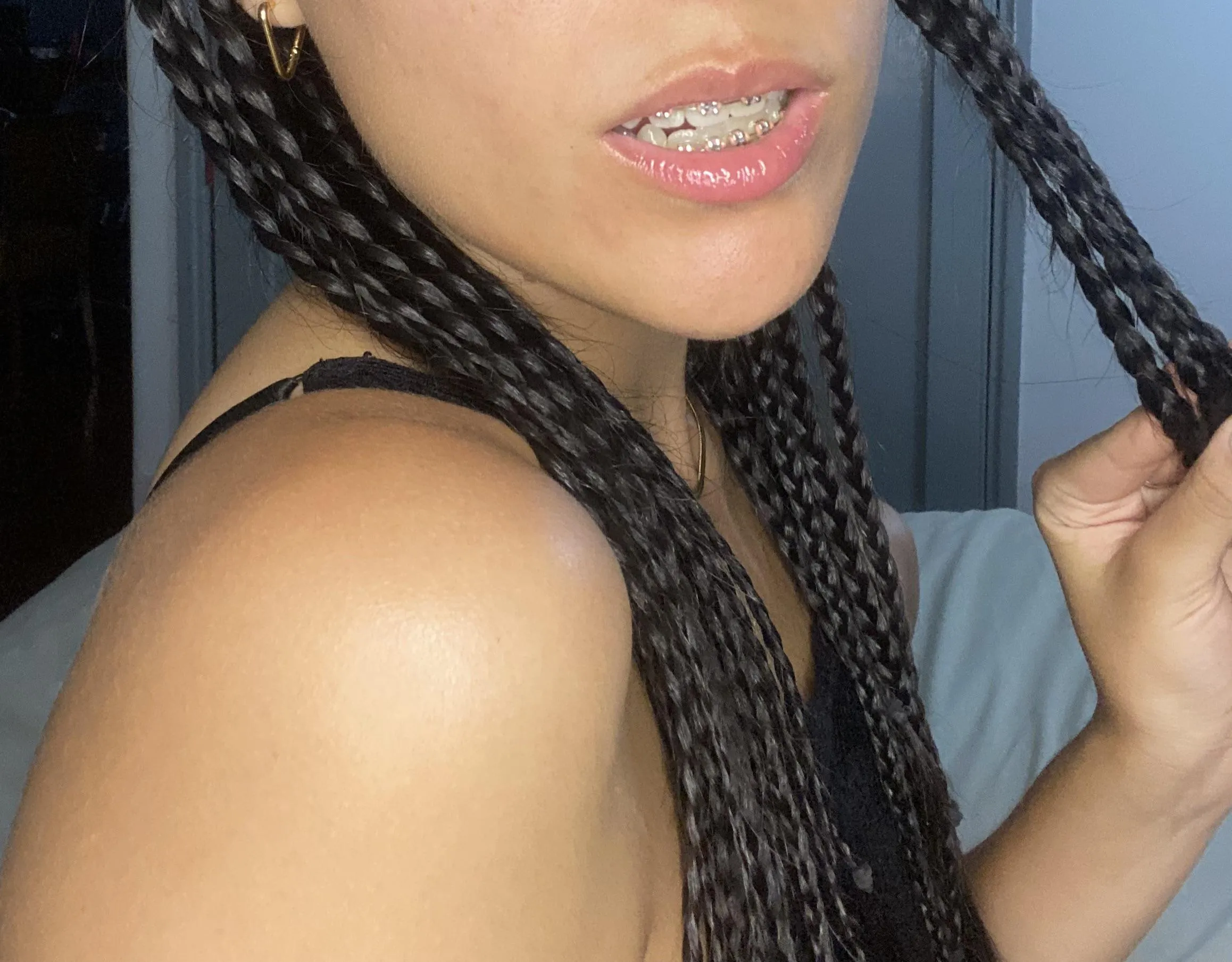 Can you resist my braces? 🥵👄