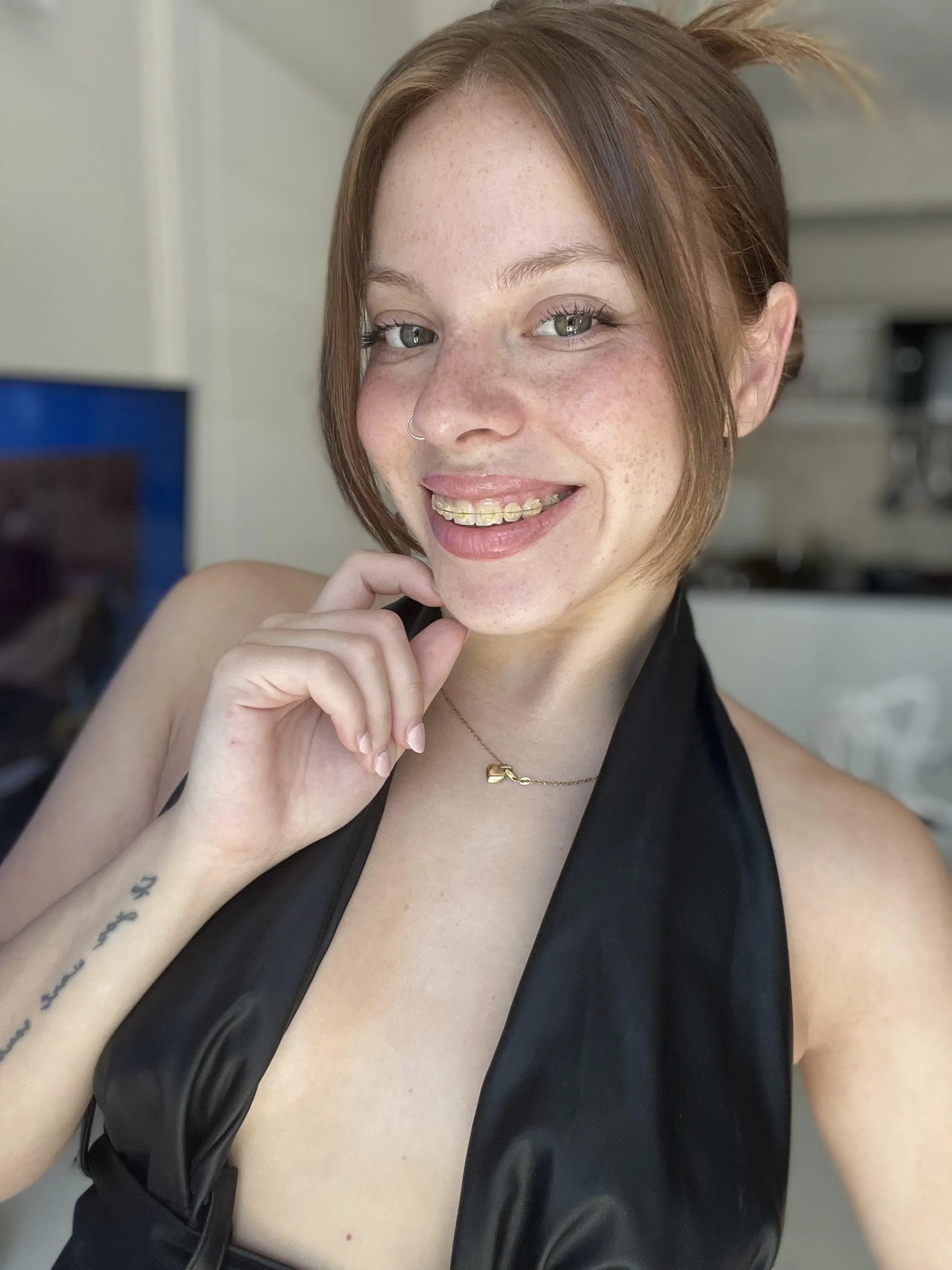 Did you miss my metal smile