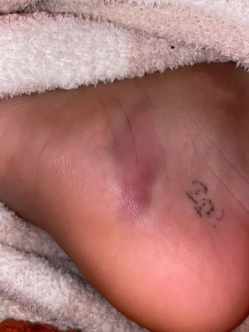 Feeling pain when standing/putting pressure on foot. Standing all day for work.