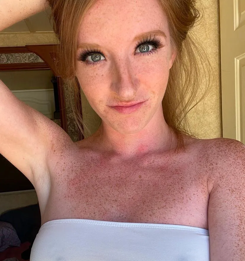 Freckles pop more and more