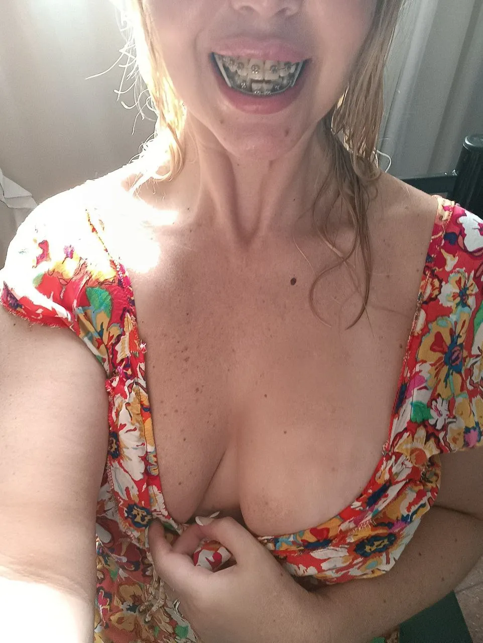 My braces make me look innocent… but you know better. 😉