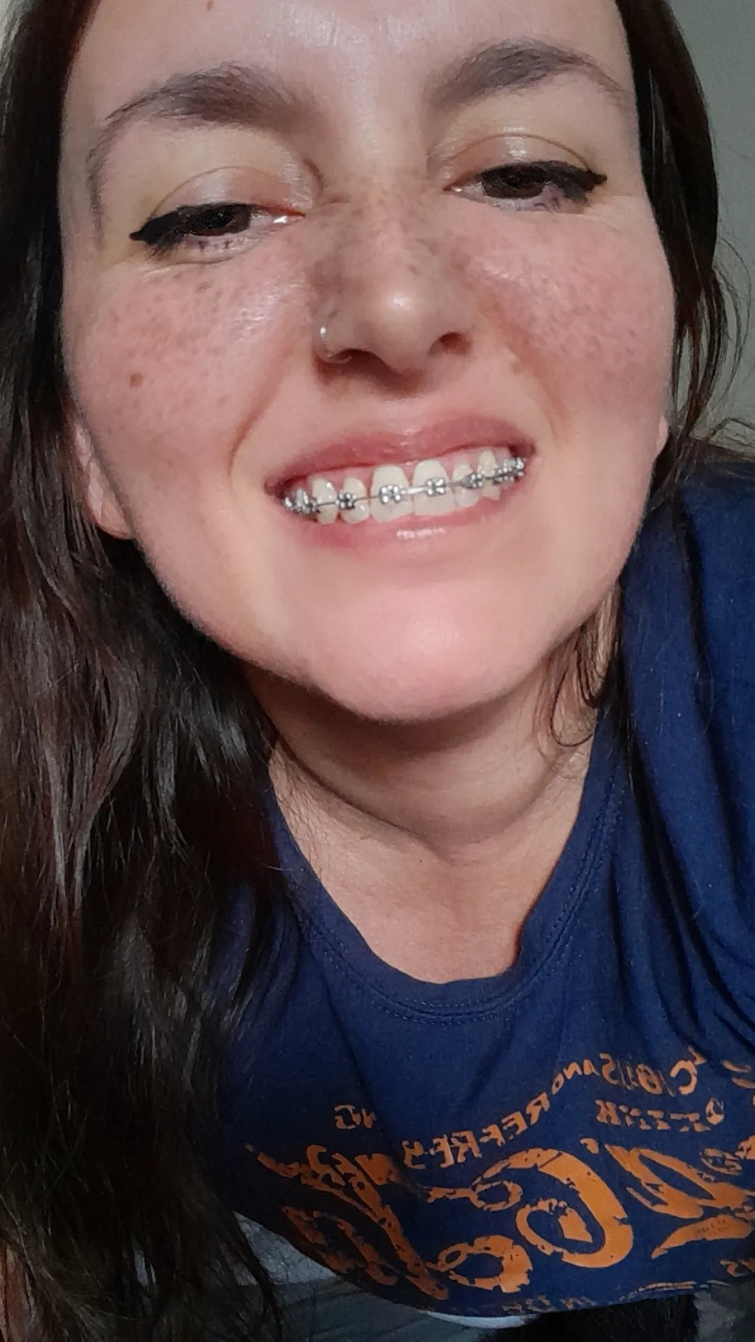 Today I went to have my braces checked