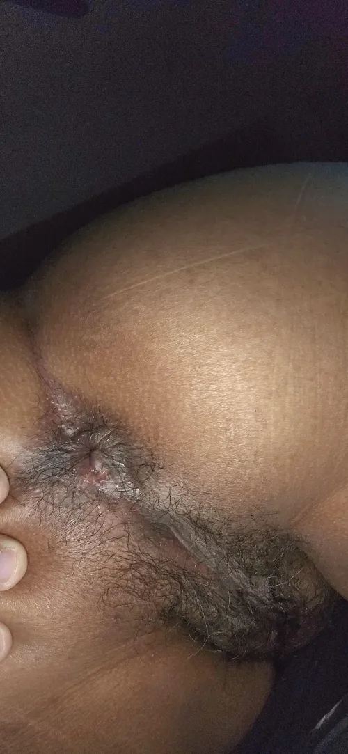 Almost 5 decades, still virgin in one hole. Any takers? What would you do?