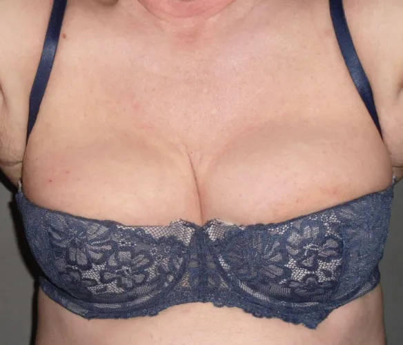 Bra of the day.