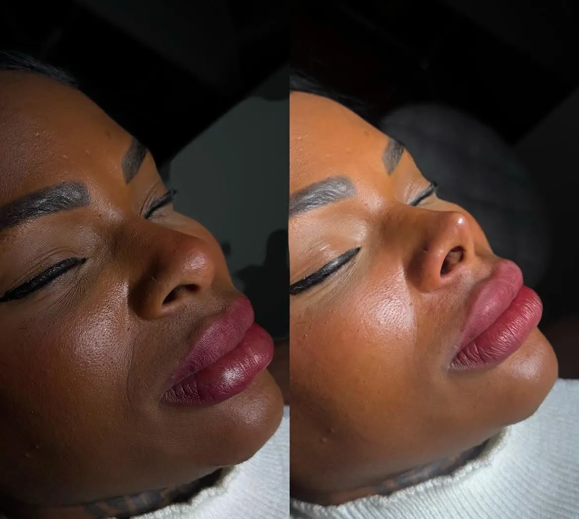 Her nose was fine before