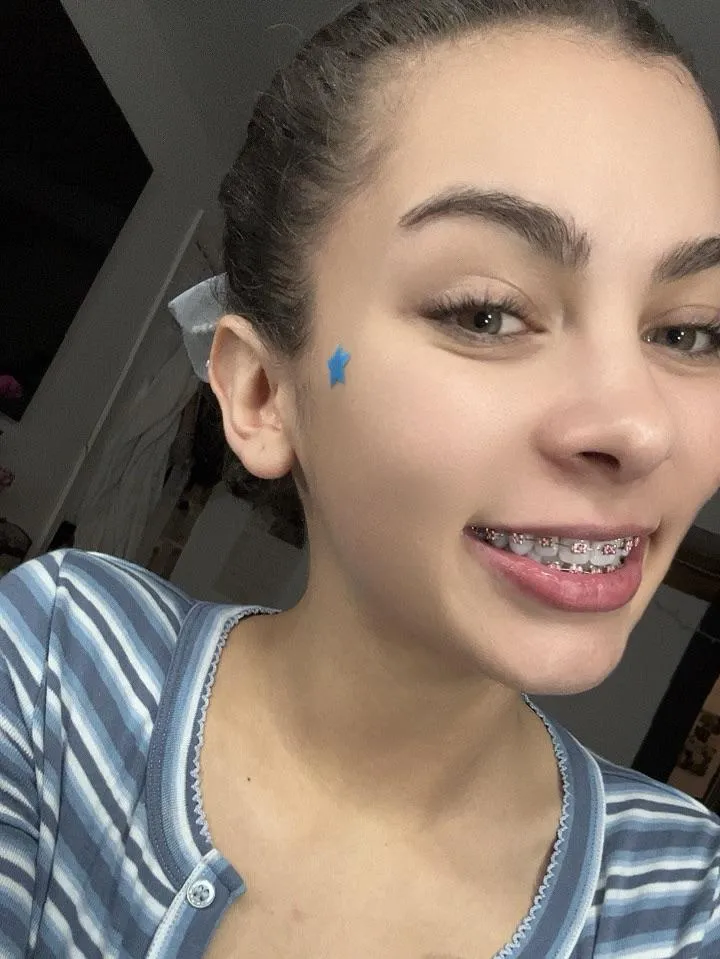 I got braces 🌸