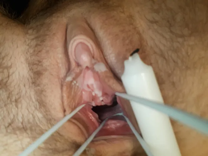 Dripping hot wax on my clit and wide open pussy 🤭