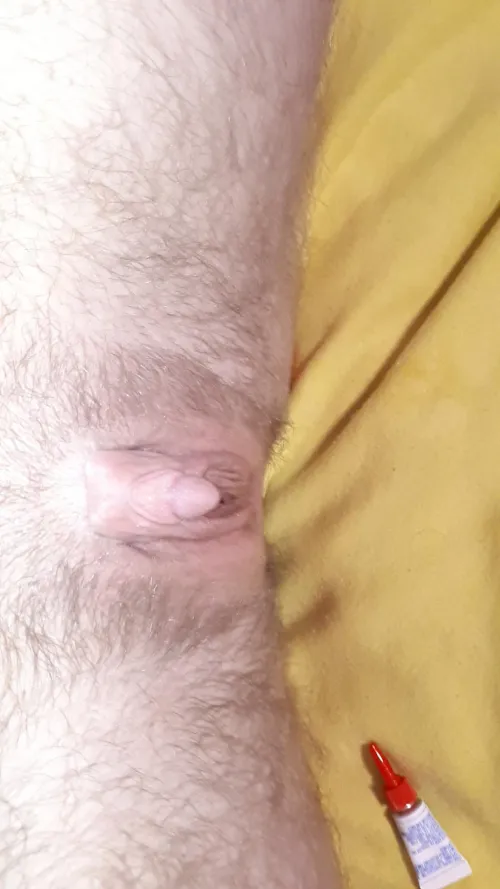 (Ftm21) Superglued clithood, to keep clit exposed and vulnerable 🤭😨