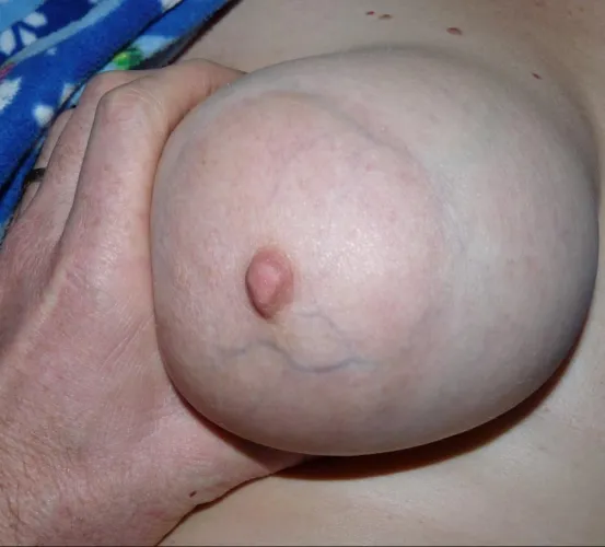 Squeeze like a balloon ?  Like?