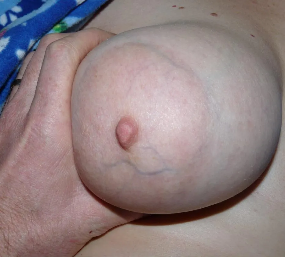 Squeeze like a balloon ?  Like?