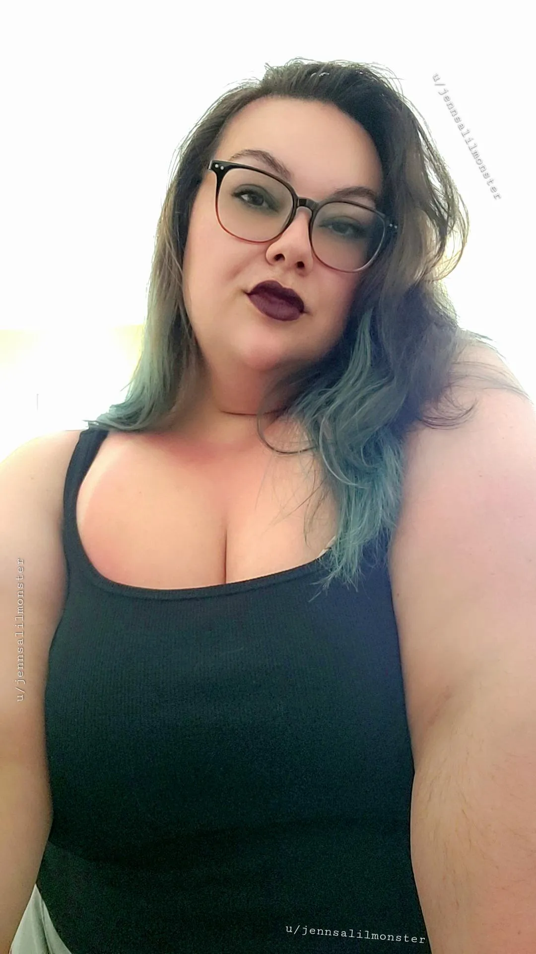 Peep the sunburn 🙈 Vacation was fun