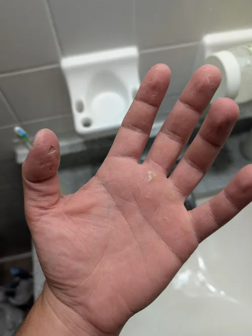 My all the cuts on my electrician hand