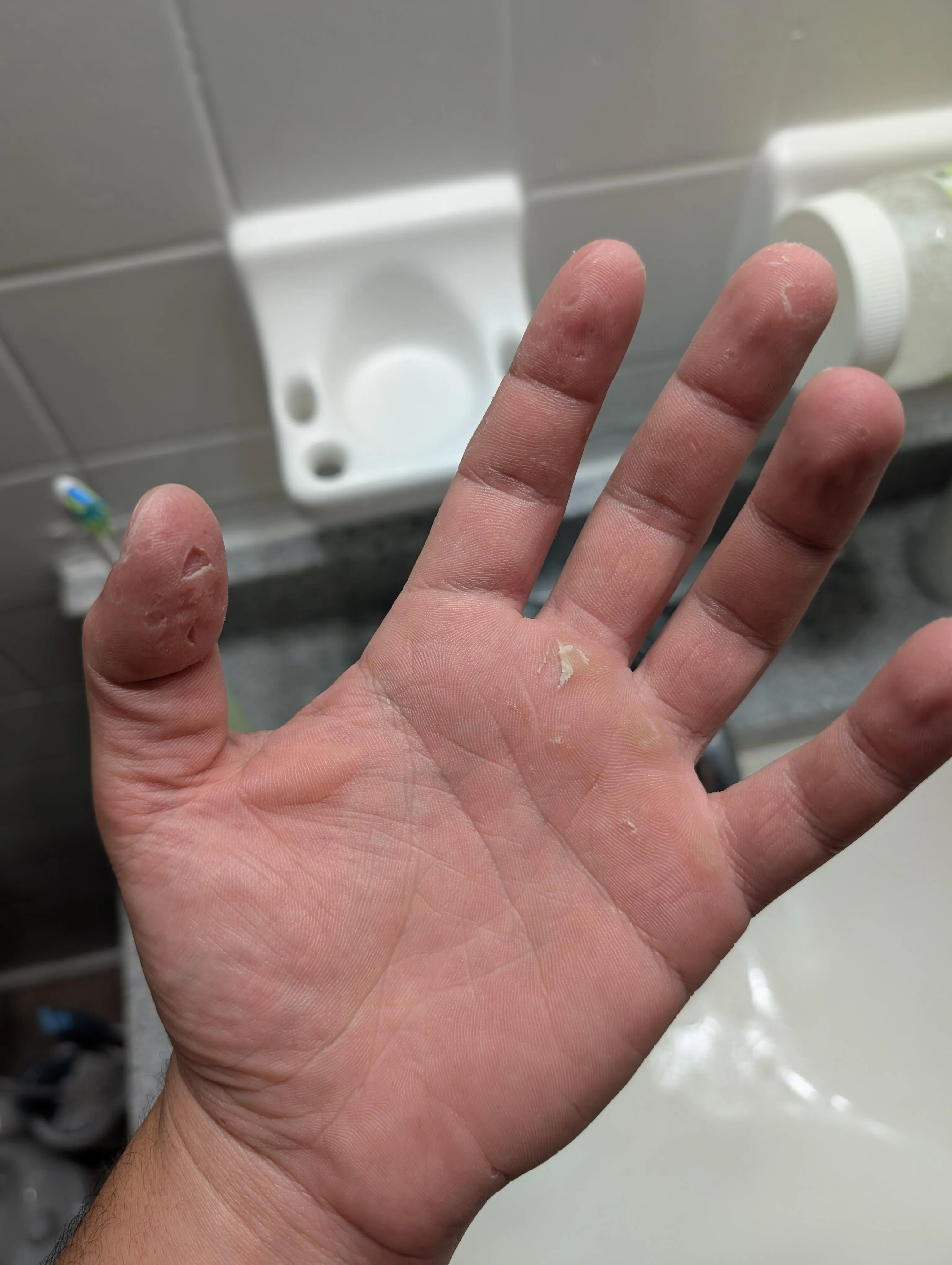 My all the cuts on my electrician hand