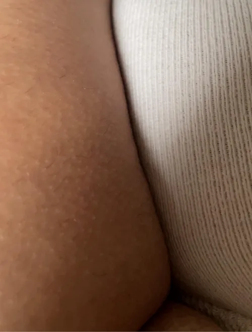 I am only wearing a stump sock