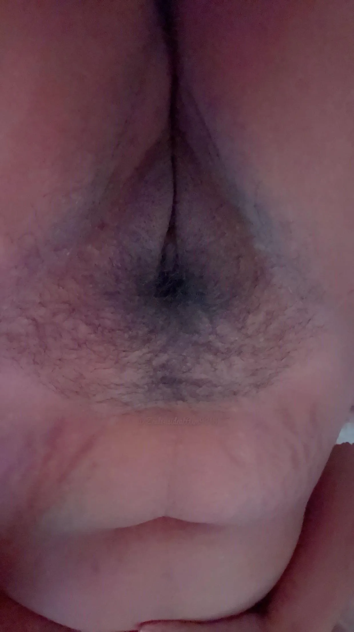 stretch marks and hairy pussy, what’s better?