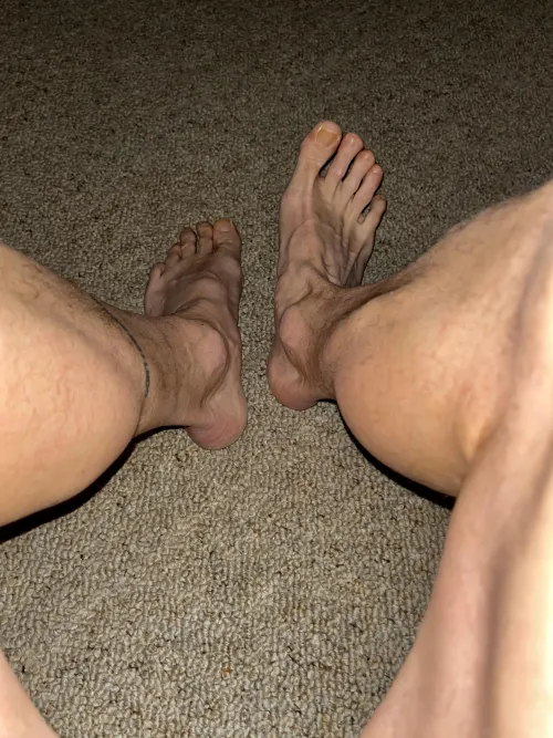 they called me „frog toes“