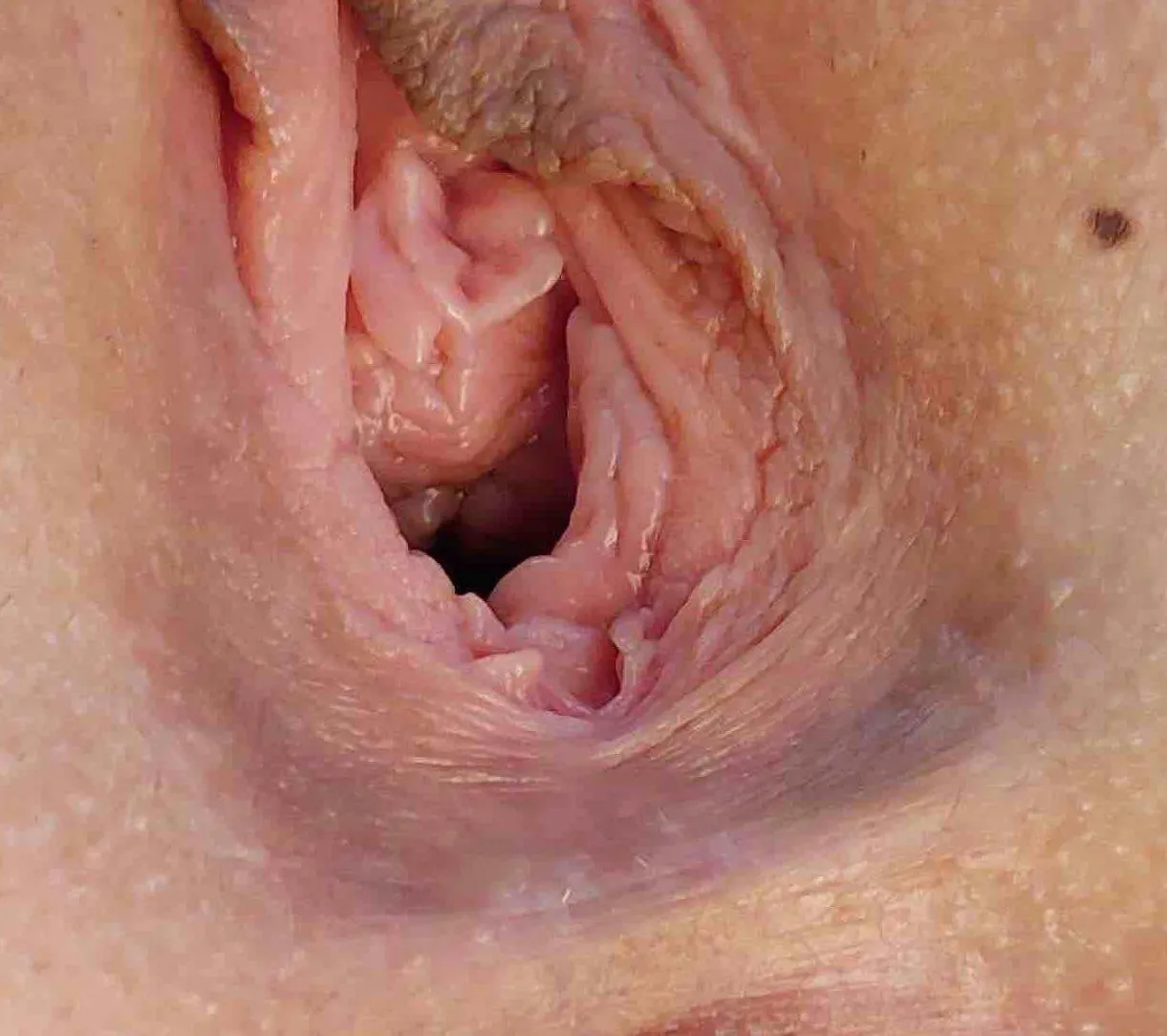 Awesome tags - look at those big ruffled ones up near her urethra and the little matching ones down by her fourchette