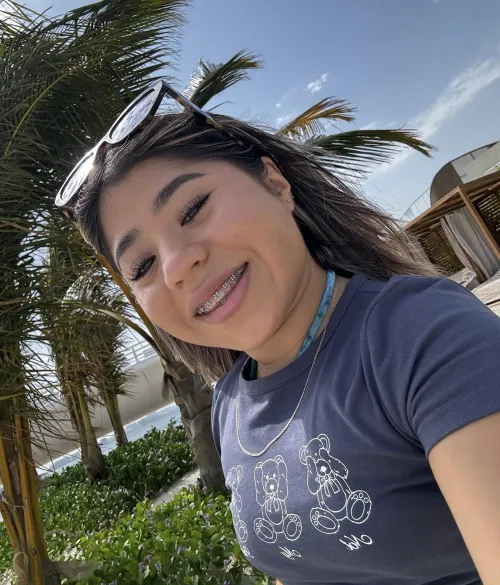 hope my metal smile isn't a turnoff