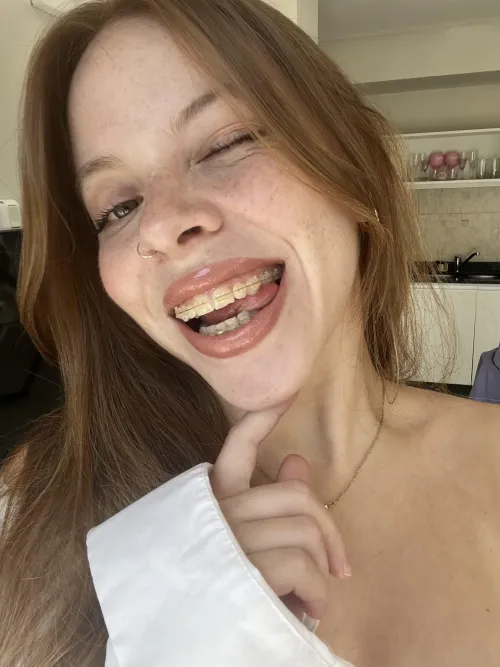 I hope you find me cute especially with my bracess hihi