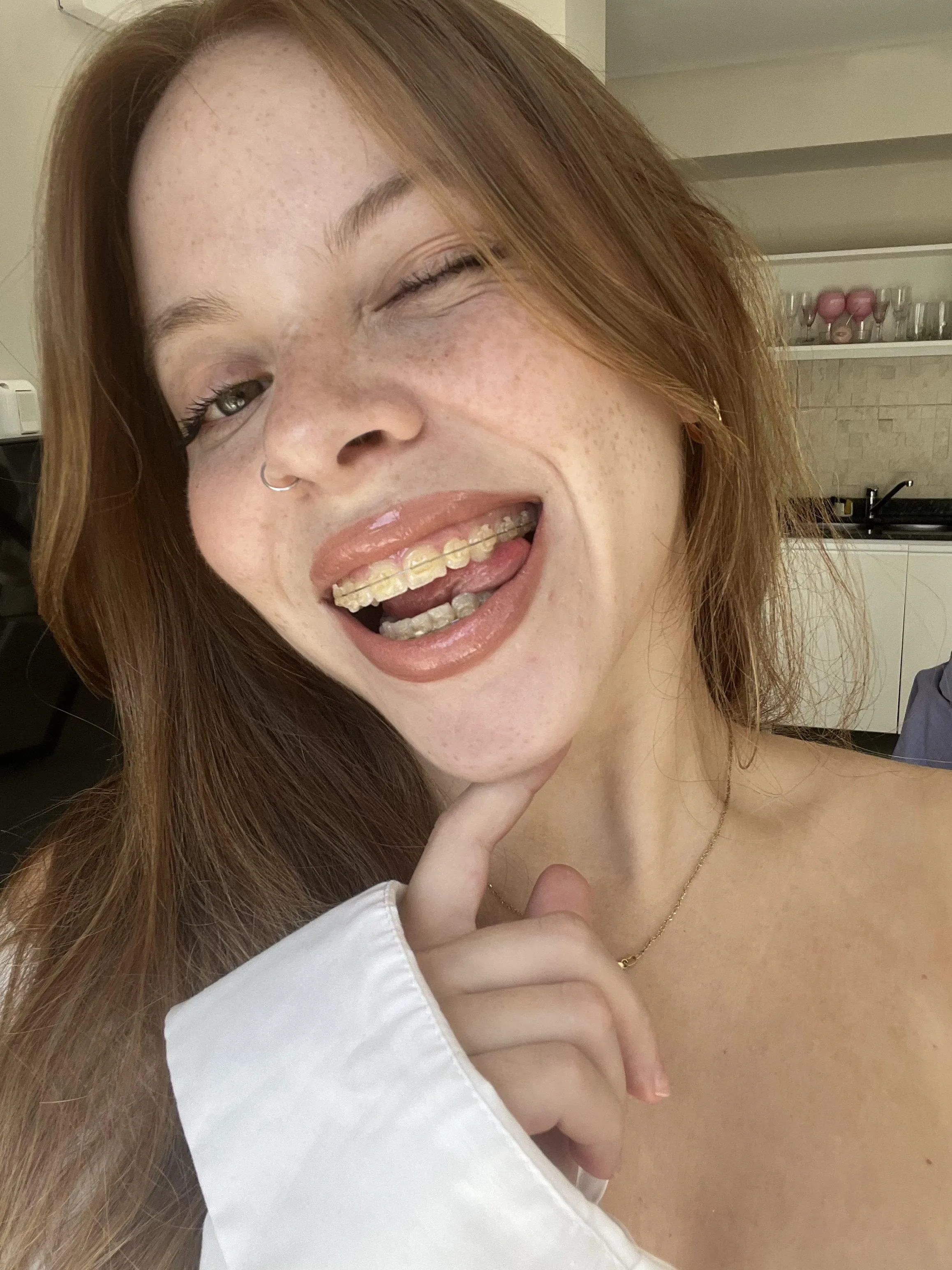 I hope you find me cute especially with my bracess hihi