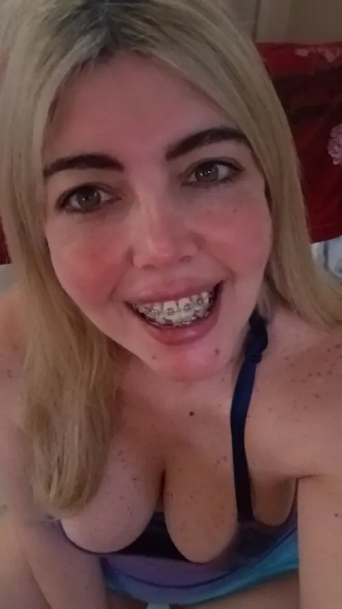 Imagine a metal kiss, would you?