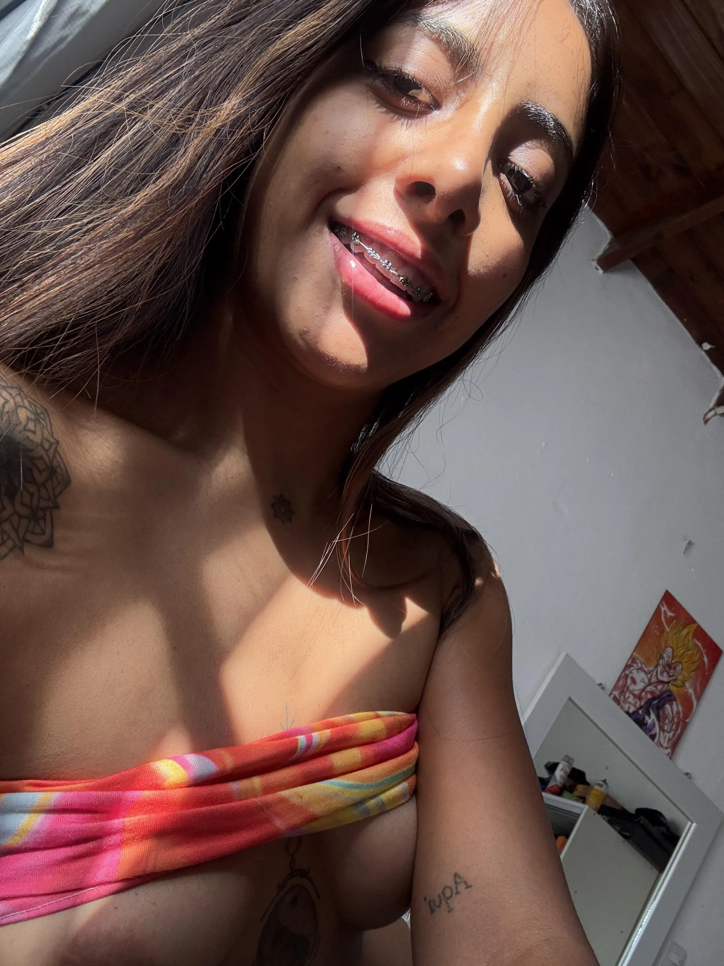 My beautiful metal braces