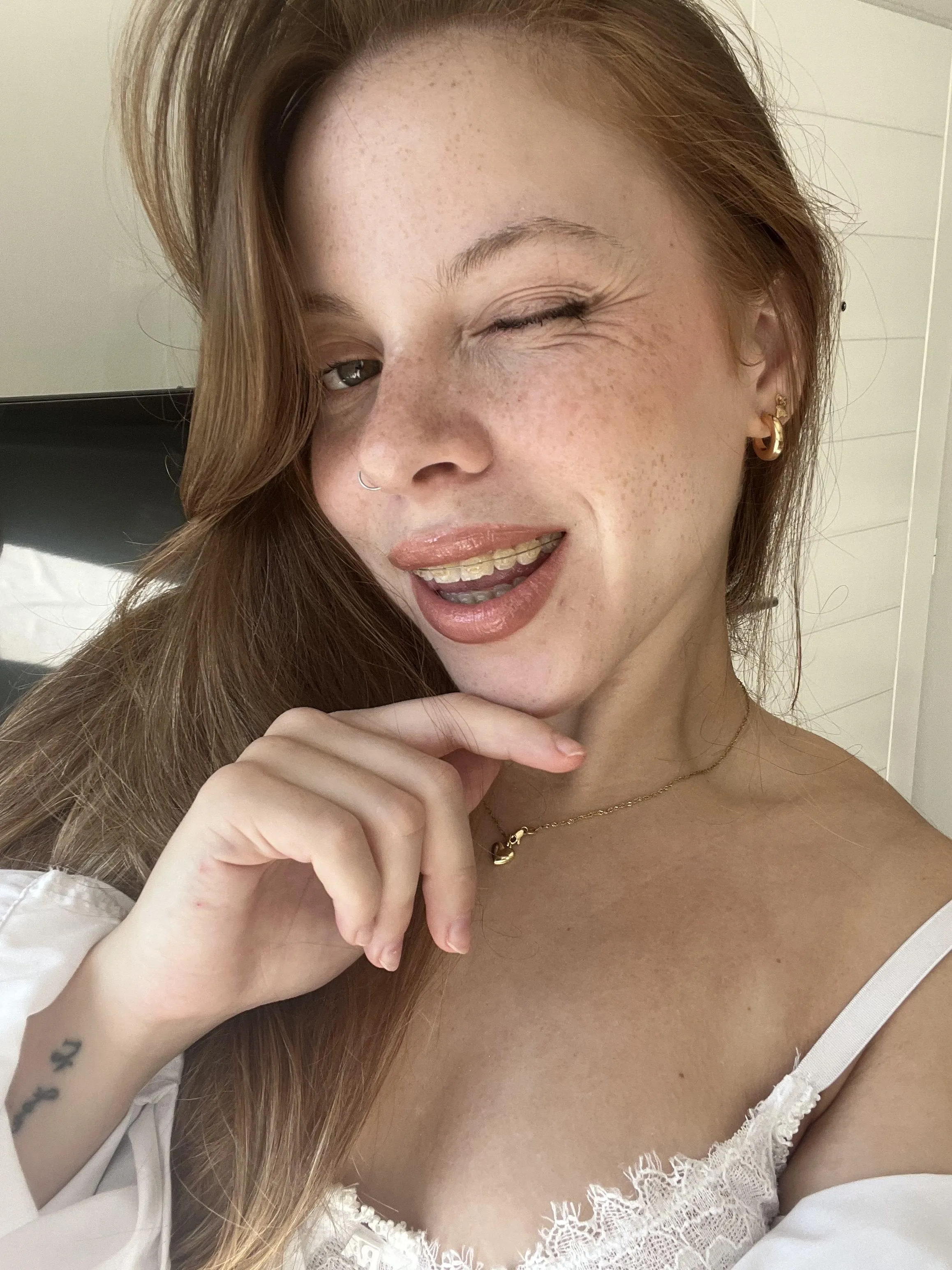 Were you ever given a blowjob by a girl with braces