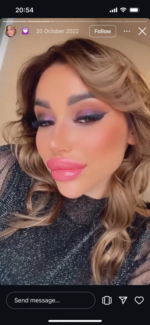 I want such lips urgently but everyone refuses to do them idk what to do