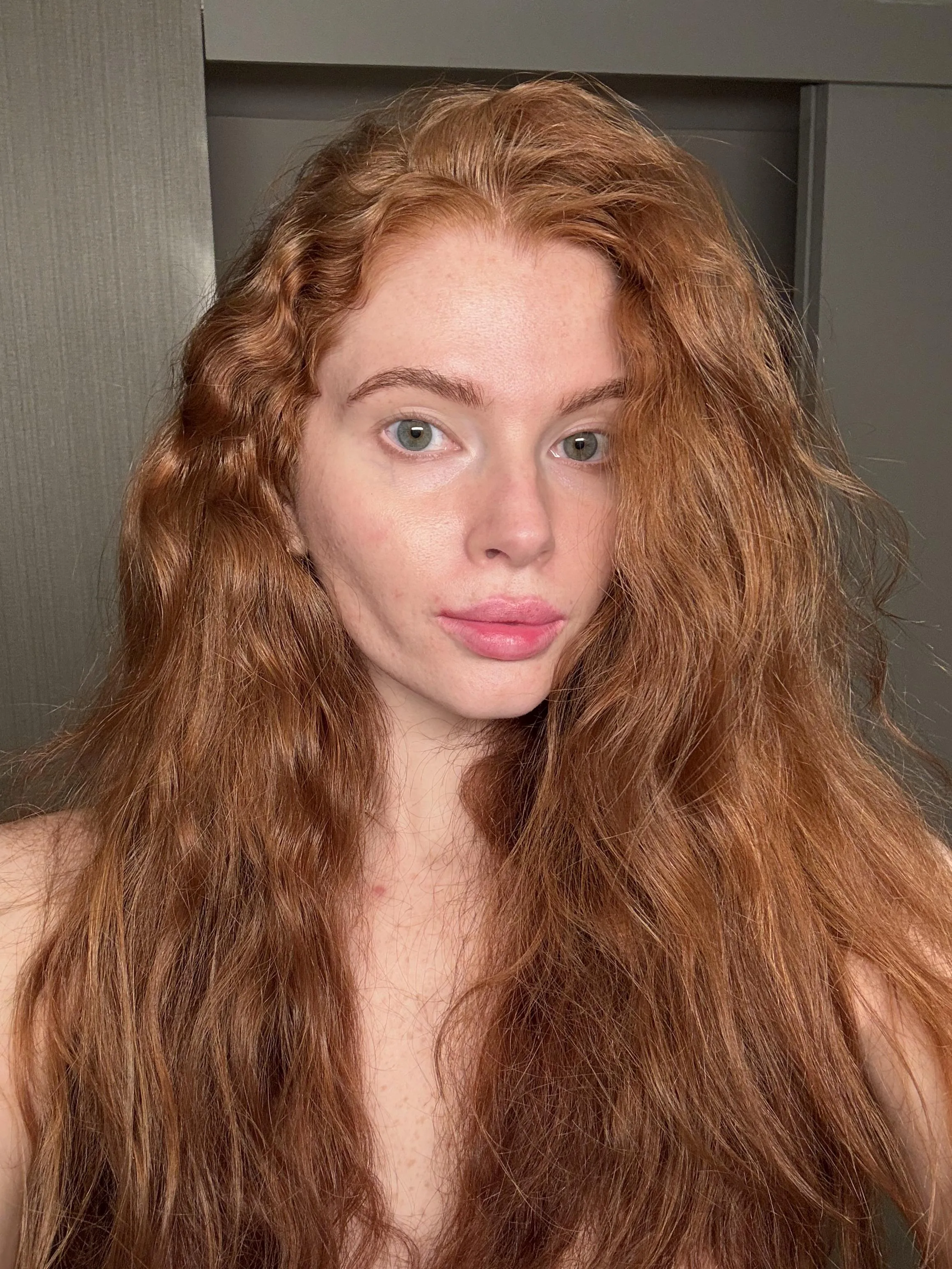 [IRTR] My freckles are coming out more now