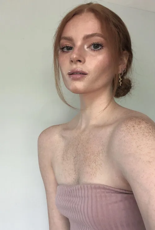 [IRTR] my freckles are really coming out