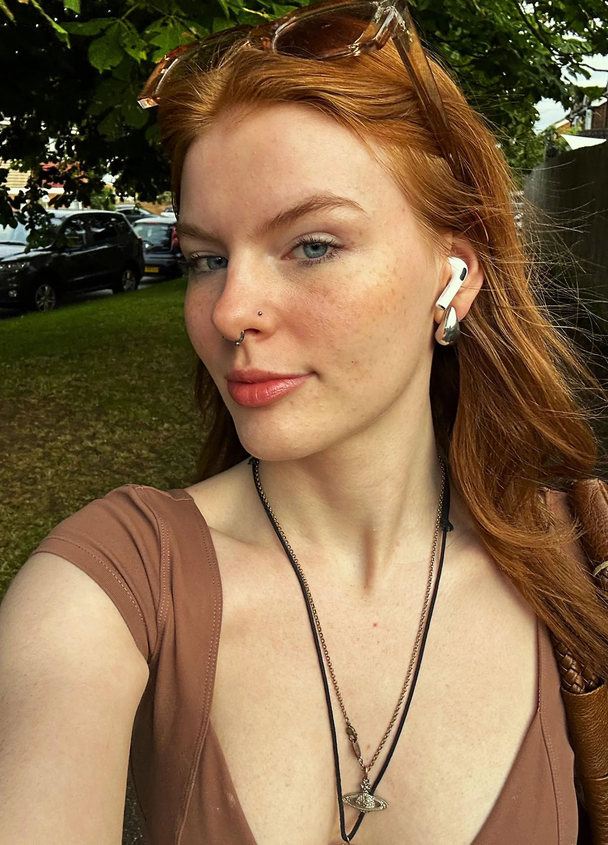 Never be ashamed of a scar or a freckle[IRTR]