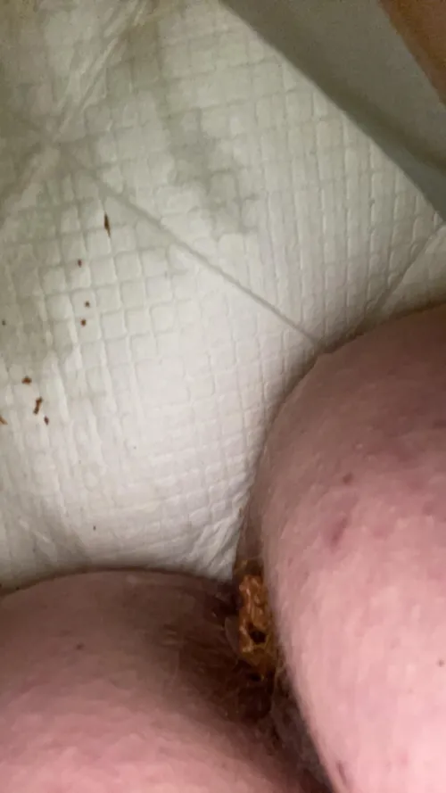 [F] Hairy, unwiped, and making a mess.