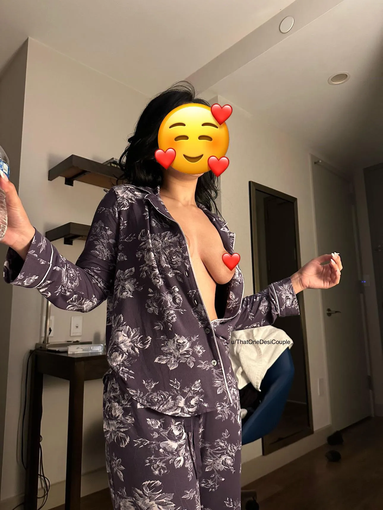 Had a little wardrobe malfunction but I’m not embarrassed