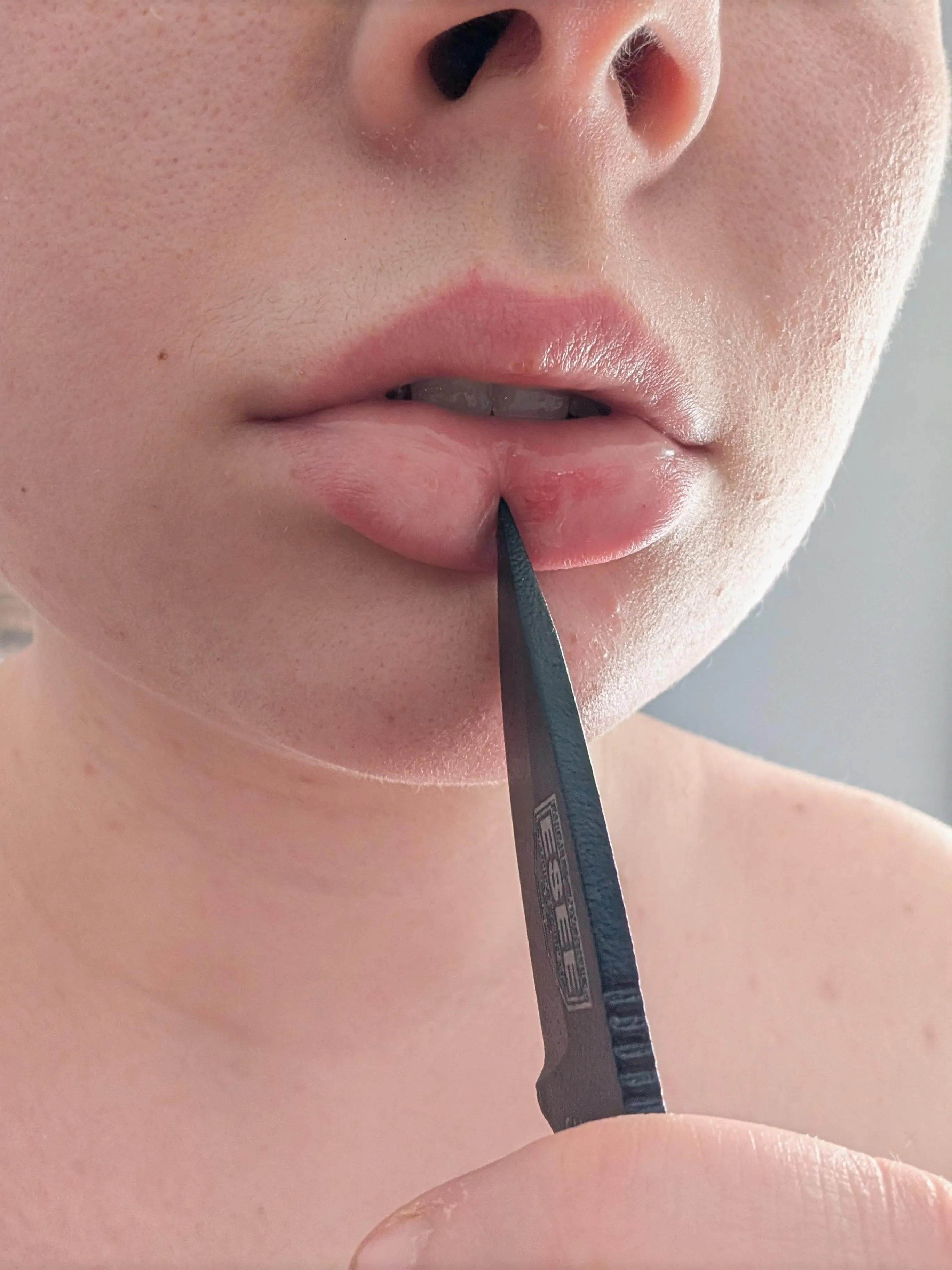 putting the cold steel to the split in my lip feels nice