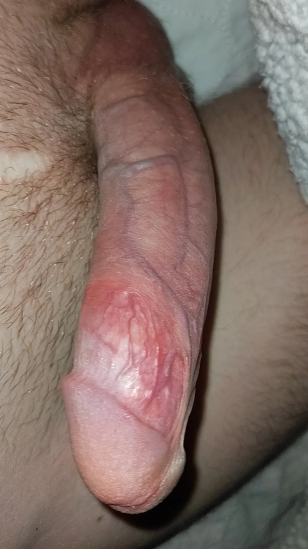 26M C7 SCI - Think he would all fit in your mouth 🤔