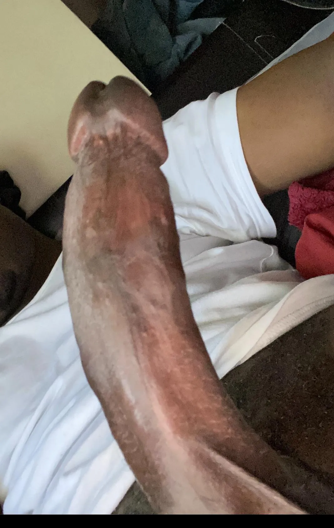 [90303] need some head