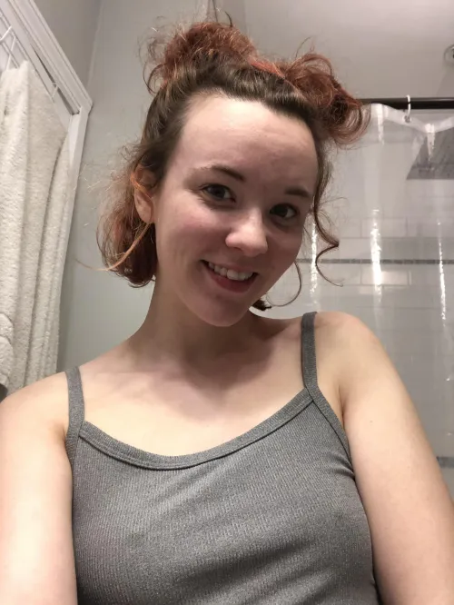 Freckles provide sweet fun